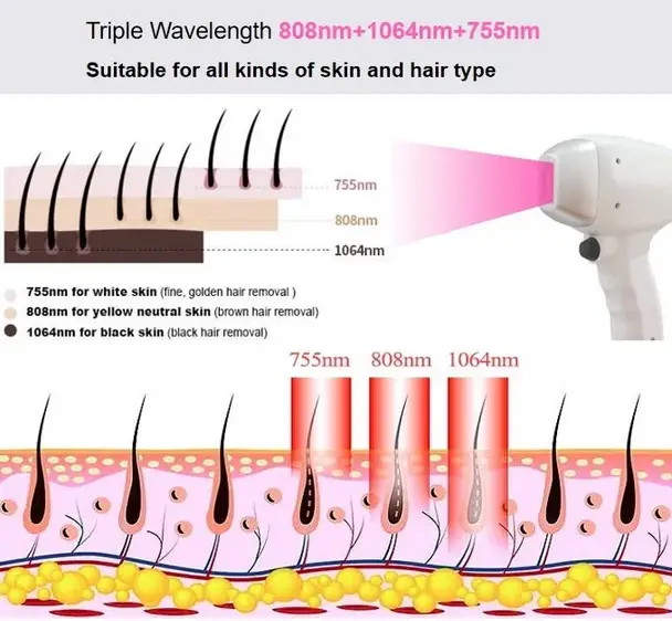 Single Handle Three Wavelength Diode Laser Single Handle Three Wavelength Diode Laser